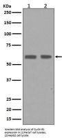 Anti-Cyclin B1 CCNB1 Rabbit Monoclonal Antibody