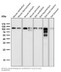 Anti-ACE2 Rabbit Monoclonal Antibody
