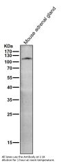 Anti-ACE2 Rabbit Monoclonal Antibody