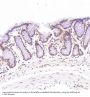 Anti-ACE2 Rabbit Monoclonal Antibody