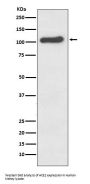 Anti-ACE2 Rabbit Monoclonal Antibody