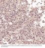 Anti-ACE2 Rabbit Monoclonal Antibody