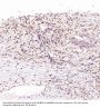 Anti-ACE2 Rabbit Monoclonal Antibody