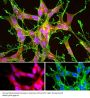 Anti-DJ1/Park7 Antibody