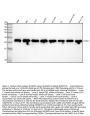 Anti-PARK7/Dj 1 Rabbit Monoclonal Antibody