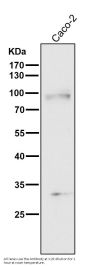 Anti-TGF beta Receptor II TGFBR2 Rabbit Monoclonal Antibody