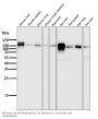 Anti-Integrin beta 1 ITGB1 Rabbit Monoclonal Antibody