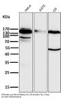 Anti-Integrin beta 1 ITGB1 Rabbit Monoclonal Antibody