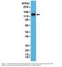 Anti-CD29 ITGB1 Rabbit Monoclonal Antibody, Clone#RM285