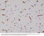 Anti-CD29 ITGB1 Rabbit Monoclonal Antibody, Clone#RM285