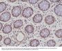 Anti-CD29 ITGB1 Rabbit Monoclonal Antibody, Clone#RM285