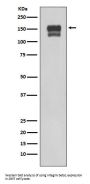 Anti-Integrin beta 1 ITGB1 Rabbit Monoclonal Antibody