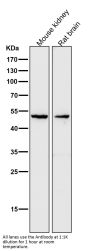Anti-MMP3 Rabbit Monoclonal Antibody