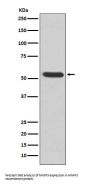 Anti-MMP3 Rabbit Monoclonal Antibody