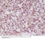 Anti-MMP3 Rabbit Monoclonal Antibody