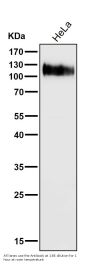 Anti-LAMP1/Cd107A Rabbit Monoclonal Antibody