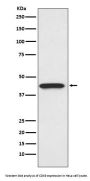 Anti-CDK9 Rabbit Monoclonal Antibody