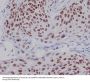 Anti-CDK9 Rabbit Monoclonal Antibody