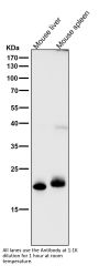 Anti-FGF21 Rabbit Monoclonal Antibody