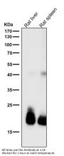 Anti-FGF21 Rabbit Monoclonal Antibody