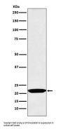 Anti-Oncostatin M Rabbit Monoclonal Antibody