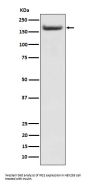 Anti-IRS2 Rabbit Monoclonal Antibody