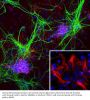 Anti-Nestin Monoclonal Antibody