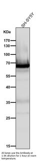 Anti-COX1 PTGS1 Rabbit Monoclonal Antibody