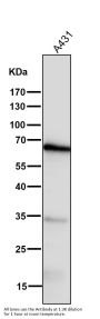 Anti-COX1 PTGS1 Rabbit Monoclonal Antibody
