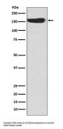 Anti-CD163 Rabbit Monoclonal Antibody