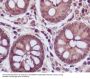 Anti-Lactate Dehydrogenase LDHA Rabbit Monoclonal Antibody