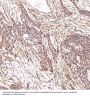 Anti-LRP1/Lrp 1 Cluster Ii Rabbit Monoclonal Antibody