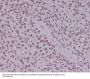 Anti-YY1 Rabbit Monoclonal Antibody