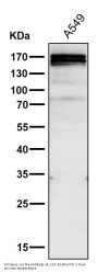 Anti-RelB Rabbit Monoclonal Antibody