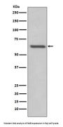 Anti-RelB Rabbit Monoclonal Antibody