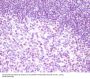 Anti-RelB Rabbit Monoclonal Antibody