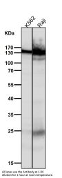 Anti-SOS1 Rabbit Monoclonal Antibody