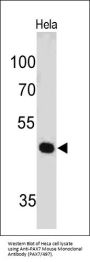 Anti-PAX7 (Rhabdomyosarcoma Marker) Monoclonal Antibody