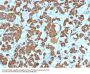 Anti-Growth Hormone (Pituitary Marker) GH1 Monoclonal Antibody