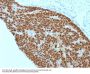 Anti-CDX2 (GI Epithelial Marker) Monoclonal Antibody
