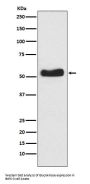 Anti-Glucokinase Rabbit Monoclonal Antibody