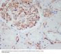Anti-CD34 Rabbit Monoclonal Antibody