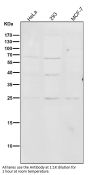 Anti-PMP22 Monoclonal Antibody