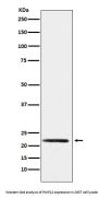 Anti-PMP22 Monoclonal Antibody