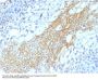 Anti-CD59 / Complement Regulatory Protein / Protectin Monoclonal Antibody