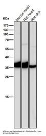 Anti-IGFBP1 Rabbit Monoclonal Antibody
