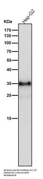 Anti-IGFBP1 Rabbit Monoclonal Antibody
