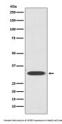Anti-IGFBP1 Rabbit Monoclonal Antibody