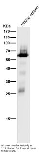 Anti-SHP1 PTPN6 Rabbit Monoclonal Antibody