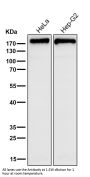 Anti-FASN/Fatty Acid Synthase Rabbit Monoclonal Antibody